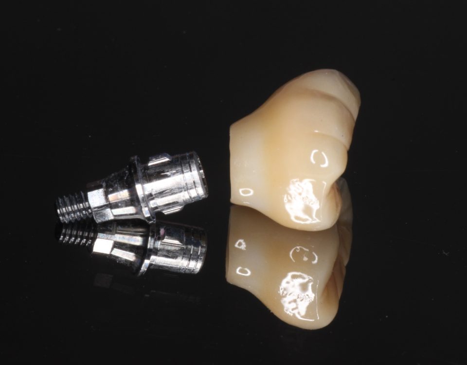 implant